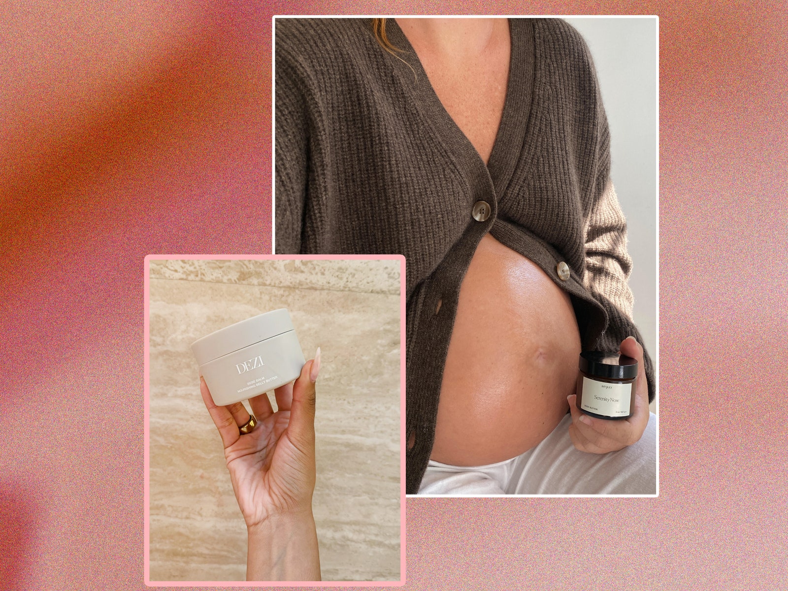 The Best Stretch Mark Creams for Pregnancy